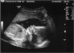 Ultrasound#3